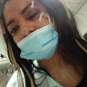 agresión homófoba en palencia