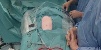 El Hospital público La Paz de la Comunidad de Madrid realiza el primer trasplante de intestino del mundo tras donación en asistolia